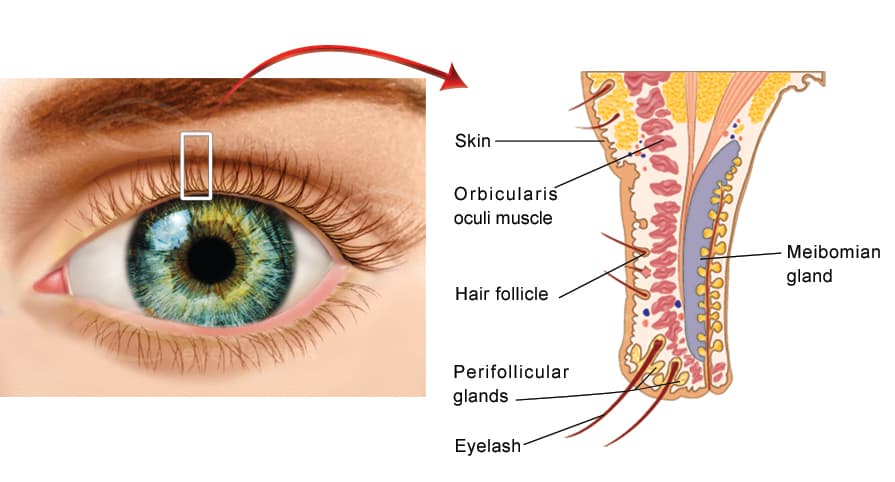 Normal eyelid-margin anatomy: lash follicles and meibomian glands