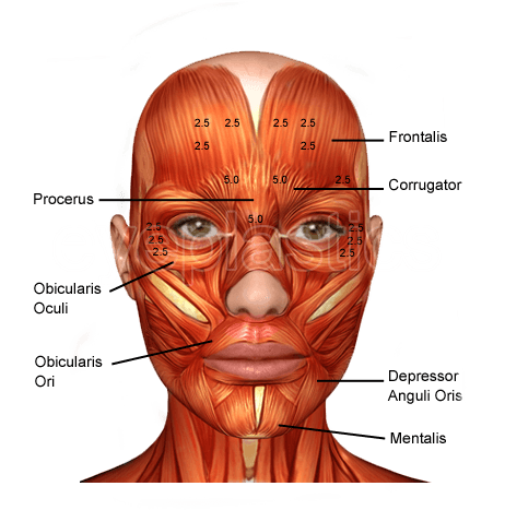Orbicularis oculi and facial muscles — blepharospasm injection anatomy