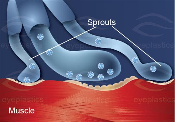Normal neuromuscular junction