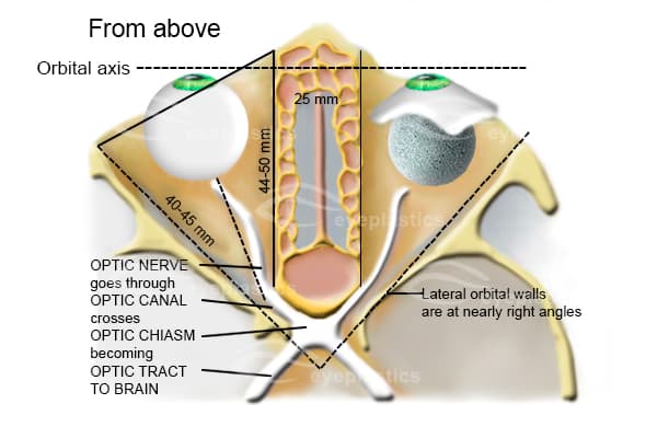 Fitted prosthesis viewed from above showing natural contour