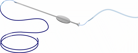 Diagram of Ritleng stent introduction through the lacrimal system