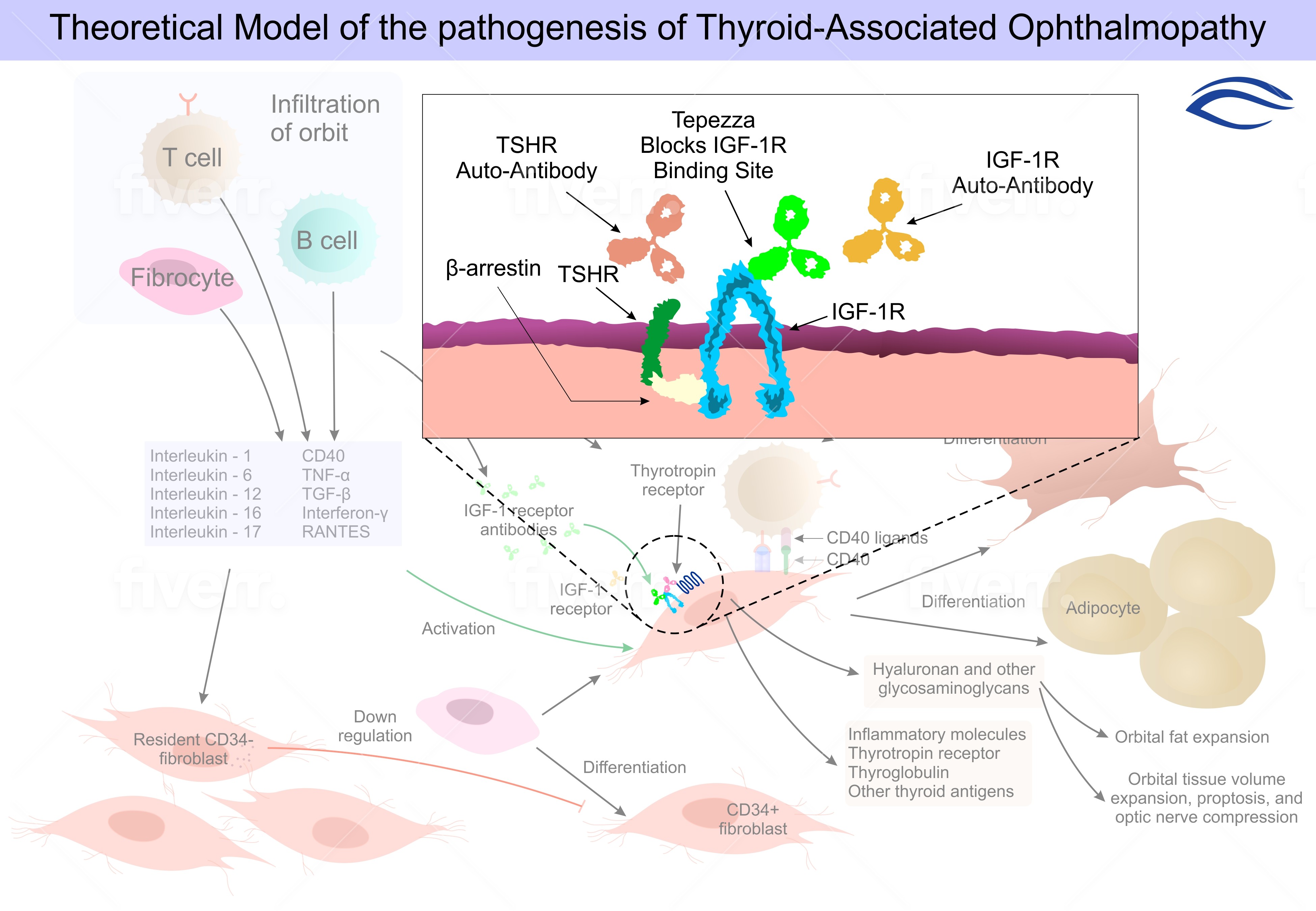 Tepezza treatment result — reduction in proptosis in thyroid eye disease